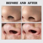 Nasal Hair Cutter, 2025 Double-Sided Nose Hairs Removal, Manual 360° Rotating Nostril Hair Removal Tool, Manual Nose Hairs Cutter, Nasal Hair Trimmer with Ear Picker for Women Men (Blue, 3PCS) - Image 7